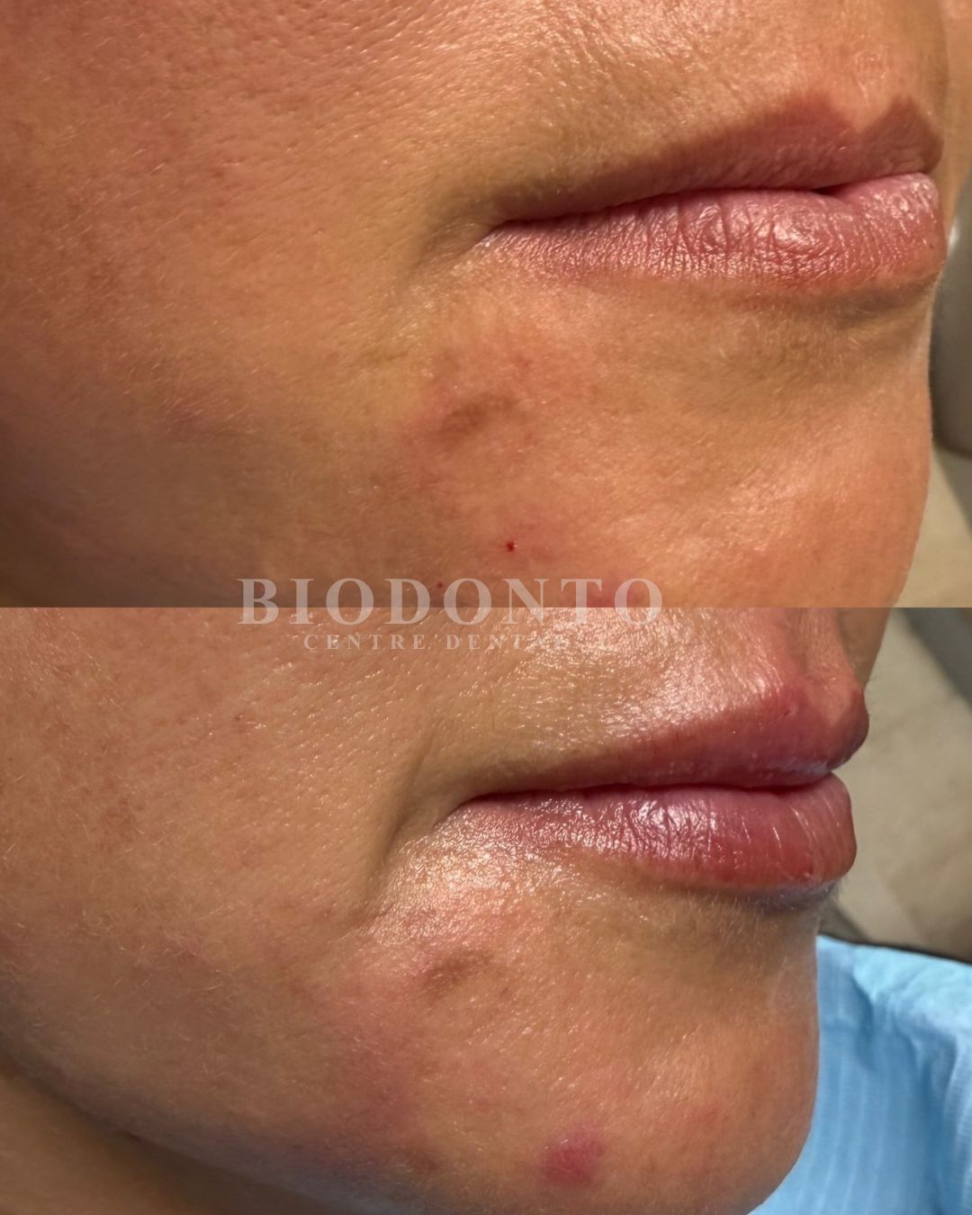 Armonización orofacial en Clínica Dental Biodonto