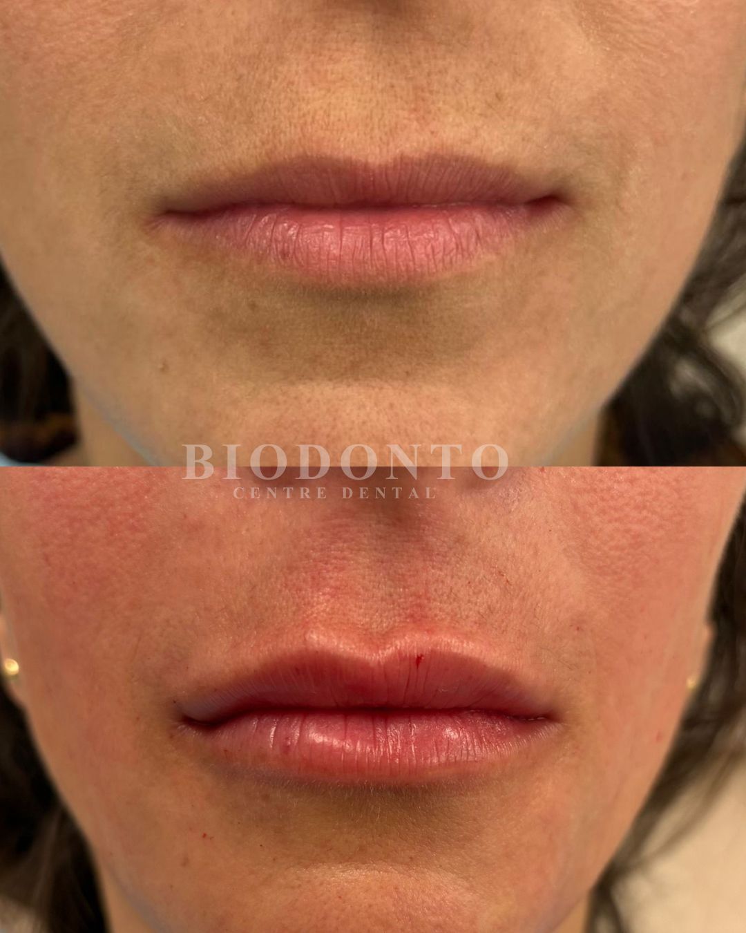 Armonización orofacial en Clínica Dental Biodonto