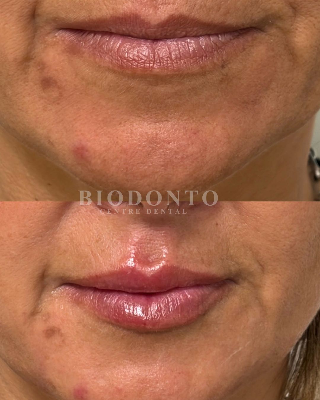 Armonización orofacial en Clínica Dental Biodonto