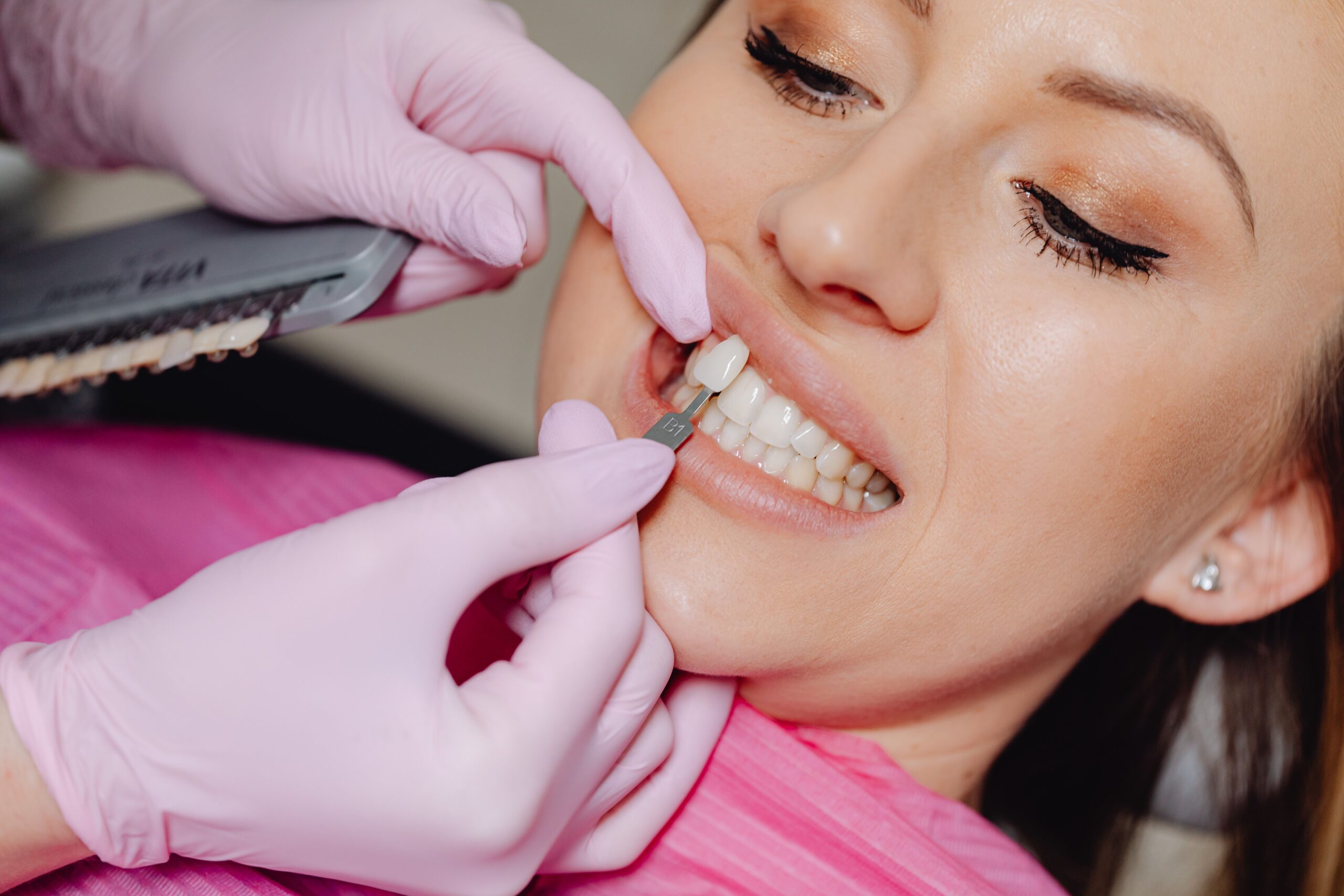 Estética dental